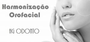 Preço de Implante Dentário no Higienópolis, Cerqueira Cesar, Consolação - SP | Implante Dentário Higienópolis Preços | Preços de Implantes Dentários no Higienópolis no Centro de São Paulo | Quanto custa implante dentário em Higienópolis, Consolação, Cerqueira Cesar | Valor implante dentário Higienópolis SP | implante dentário preço Higienópolis |