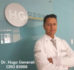 Preço de Implante Dentário no Higienópolis, Cerqueira Cesar, Consolação - SP | Implante Dentário Higienópolis Preços | Preços de Implantes Dentários no Higienópolis no Centro de São Paulo | Quanto custa implante dentário em Higienópolis, Consolação, Cerqueira Cesar | Valor implante dentário Higienópolis SP | implante dentário preço Higienópolis |