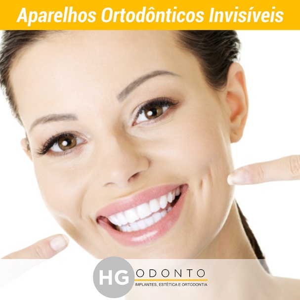 Preço de Implante Dentário no Higienópolis, Cerqueira Cesar, Consolação - SP Preço de Implante Dentário no Higienópolis, Cerqueira Cesar, Consolação - SP