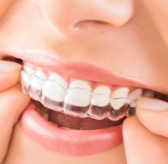 Dentista especialista em Ortodontia na Vila Formosa perto de mim 400m, 800, 1km - Preço de tratamento ortodôntico na Vila Formosa, Zona Leste - SP - Coordenada -23.564529533970695, -46.54574621349303